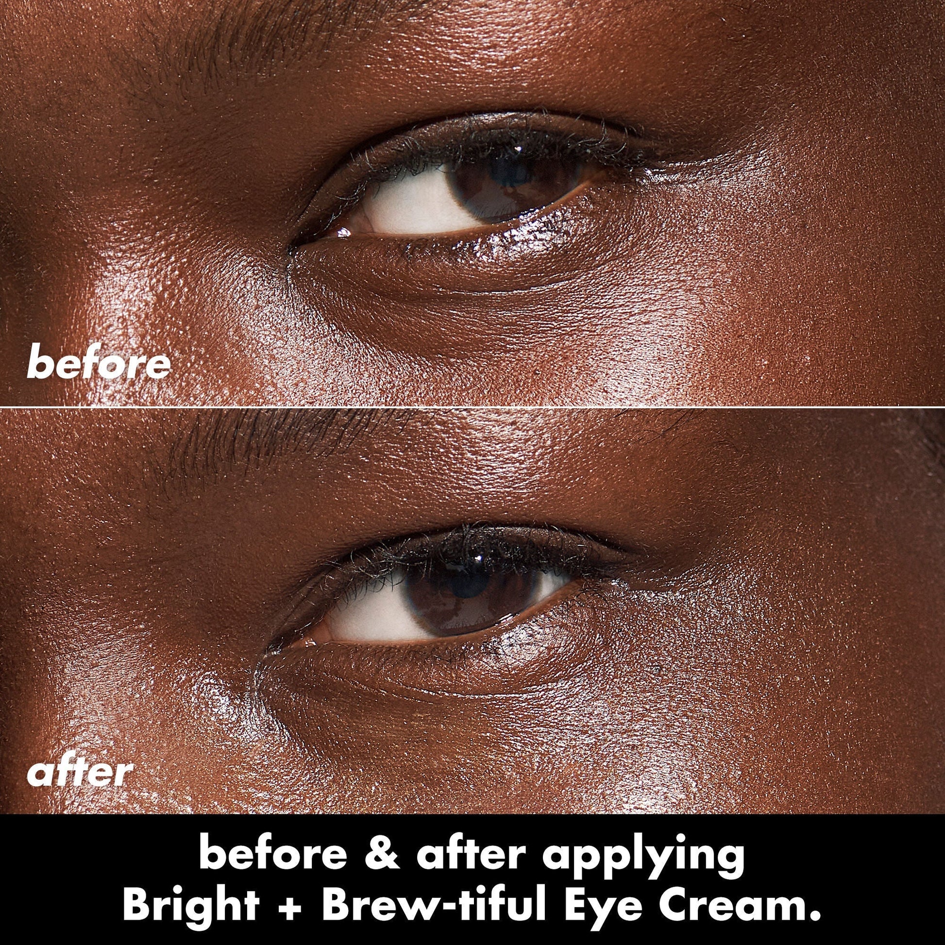 bright-brew-tiful-eye-cream-u1 0226_BBEC_Eye_BA_Diptych_607e3ec2-f0e1-4365-9b28-17574d841250.jpg
