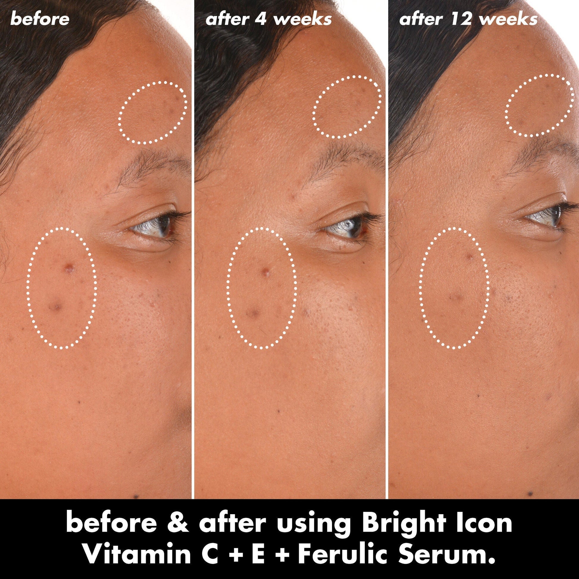 bright-icon-vitamin-c-e-ferulic-serum-r4 0226_EDU_BrightIconVitC_BA_Chanel_TRIPTYCH_c58f2fc8-209d-414f-9ba3-666a07a94887.jpg