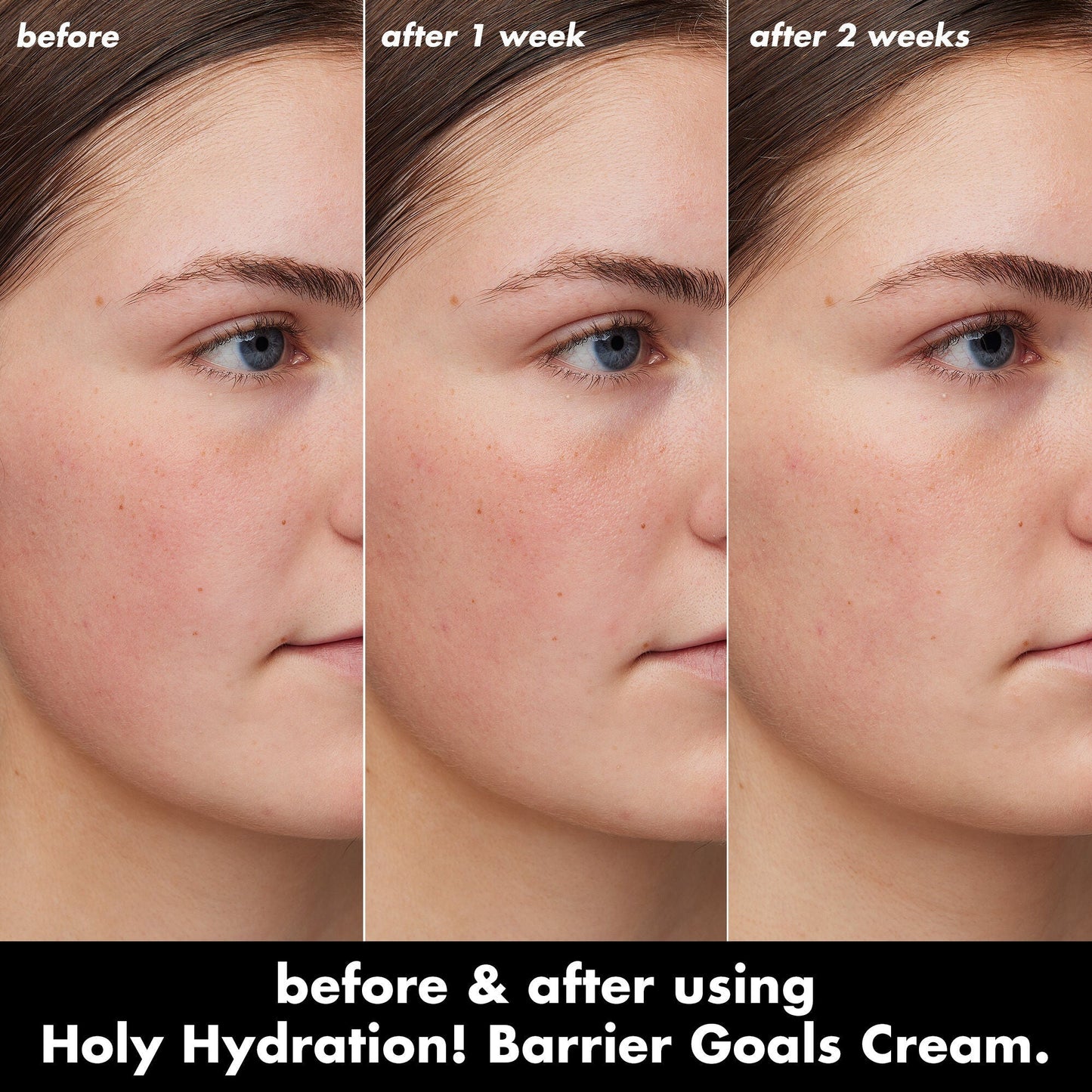 holy-hydration-barrier-goals-cream-q2 0226_EDU_HHBarrierGoalsCream_B_A_Zoe_TRYPTICH_710f5249-3a6b-41fd-89e4-817294dd9258.jpg