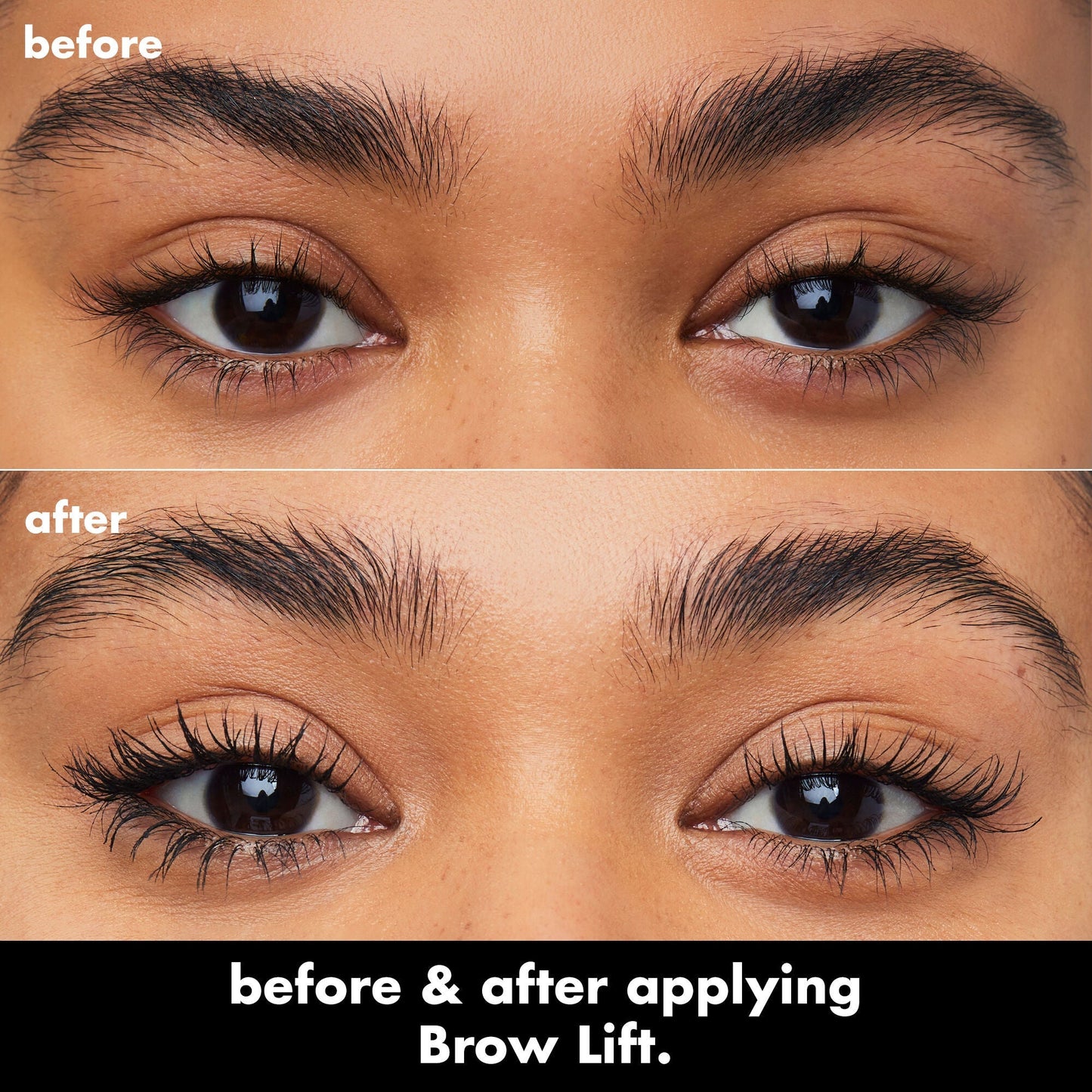 brow-lift-k0 0326_EDU_BrowLift_BA.jpg