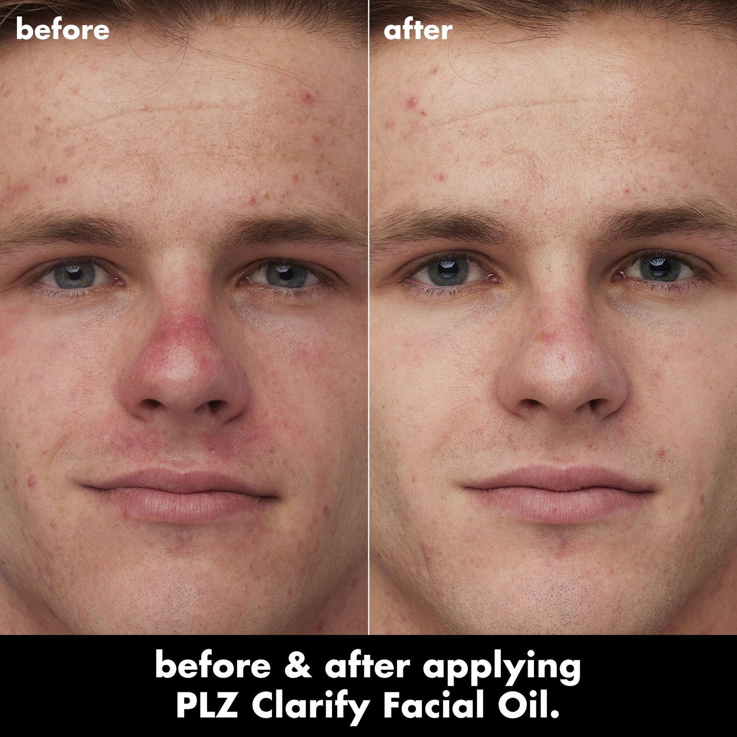 plz-clarify-facial-oil-s7 0326_EDU_PlzClarify_BA_Caleb.jpg