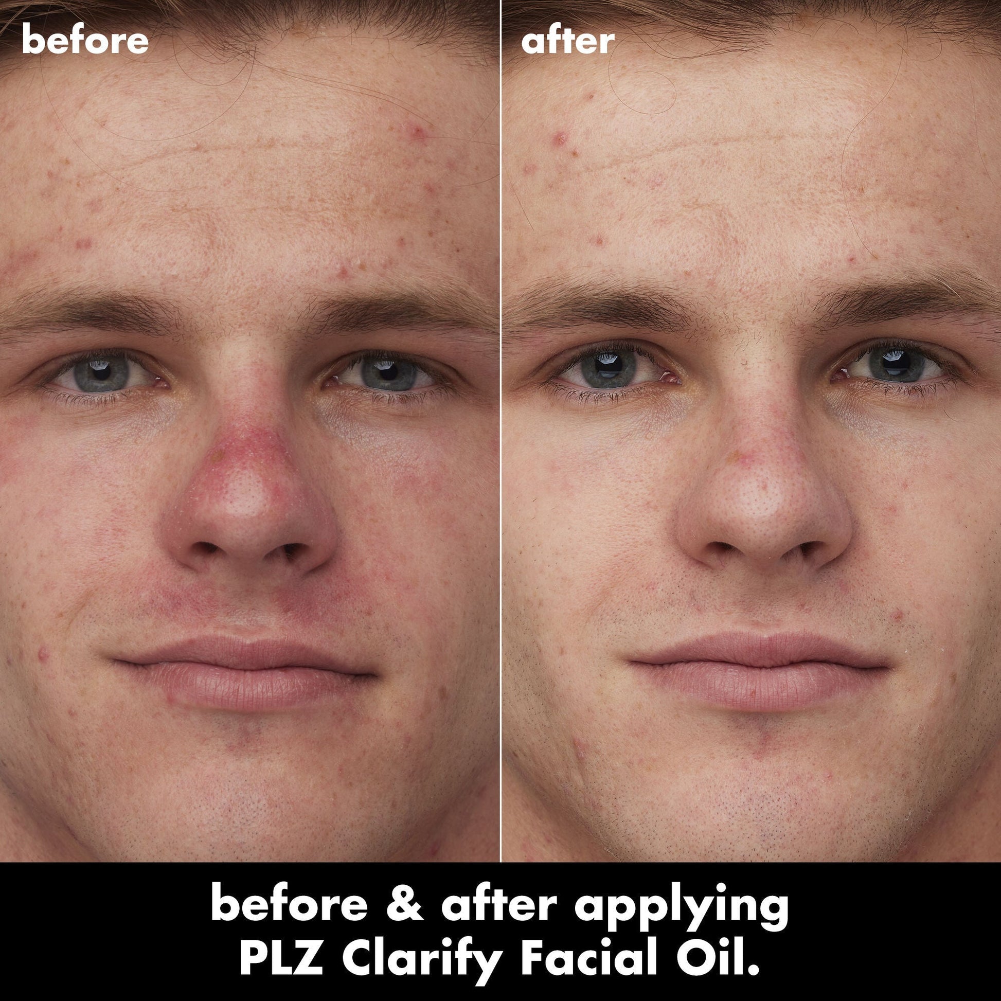 plz-clarify-facial-oil-s7 0326_EDU_PlzClarify_BA_Caleb.jpg