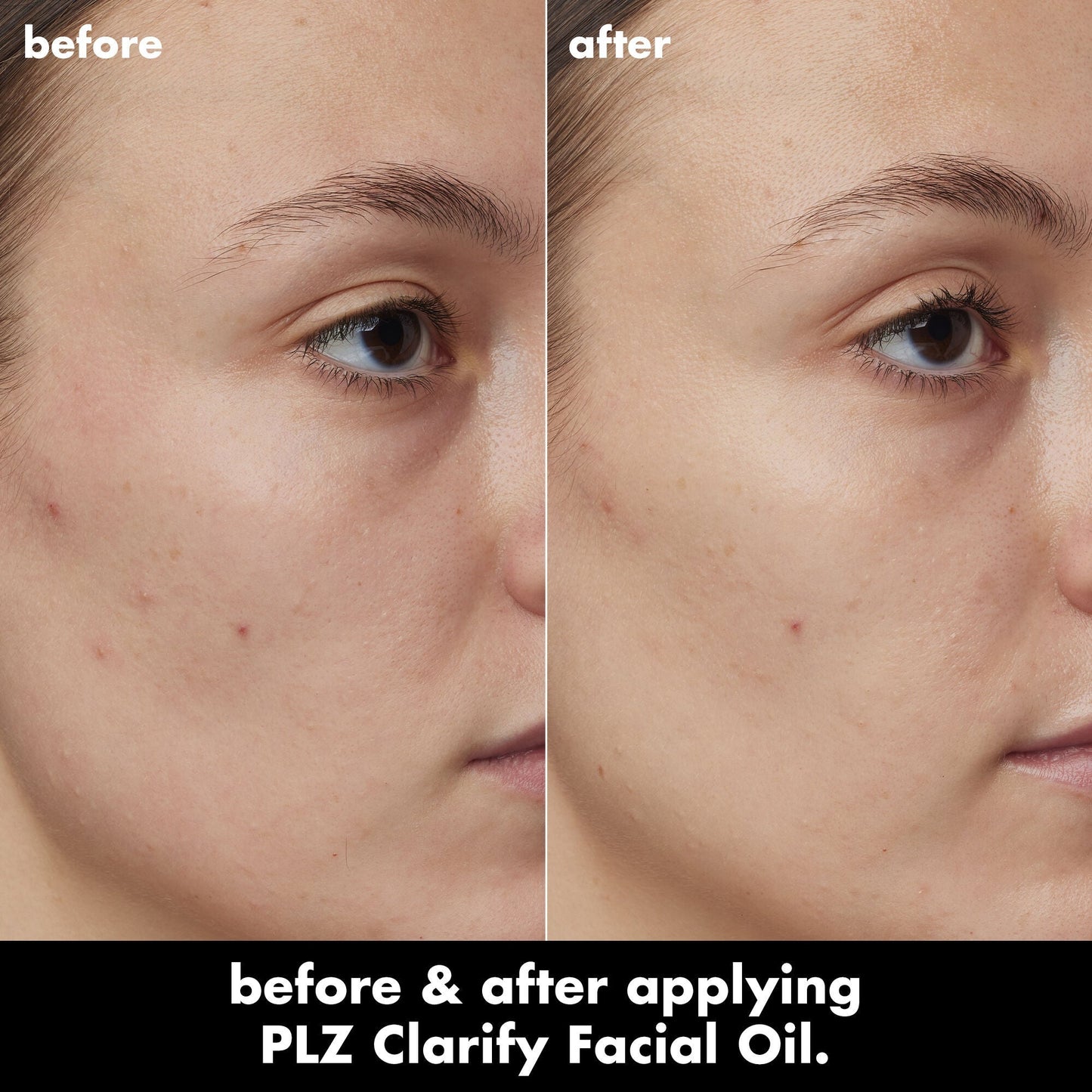 plz-clarify-facial-oil-s7 0326_EDU_PlzClarify_BA_Kelly.jpg