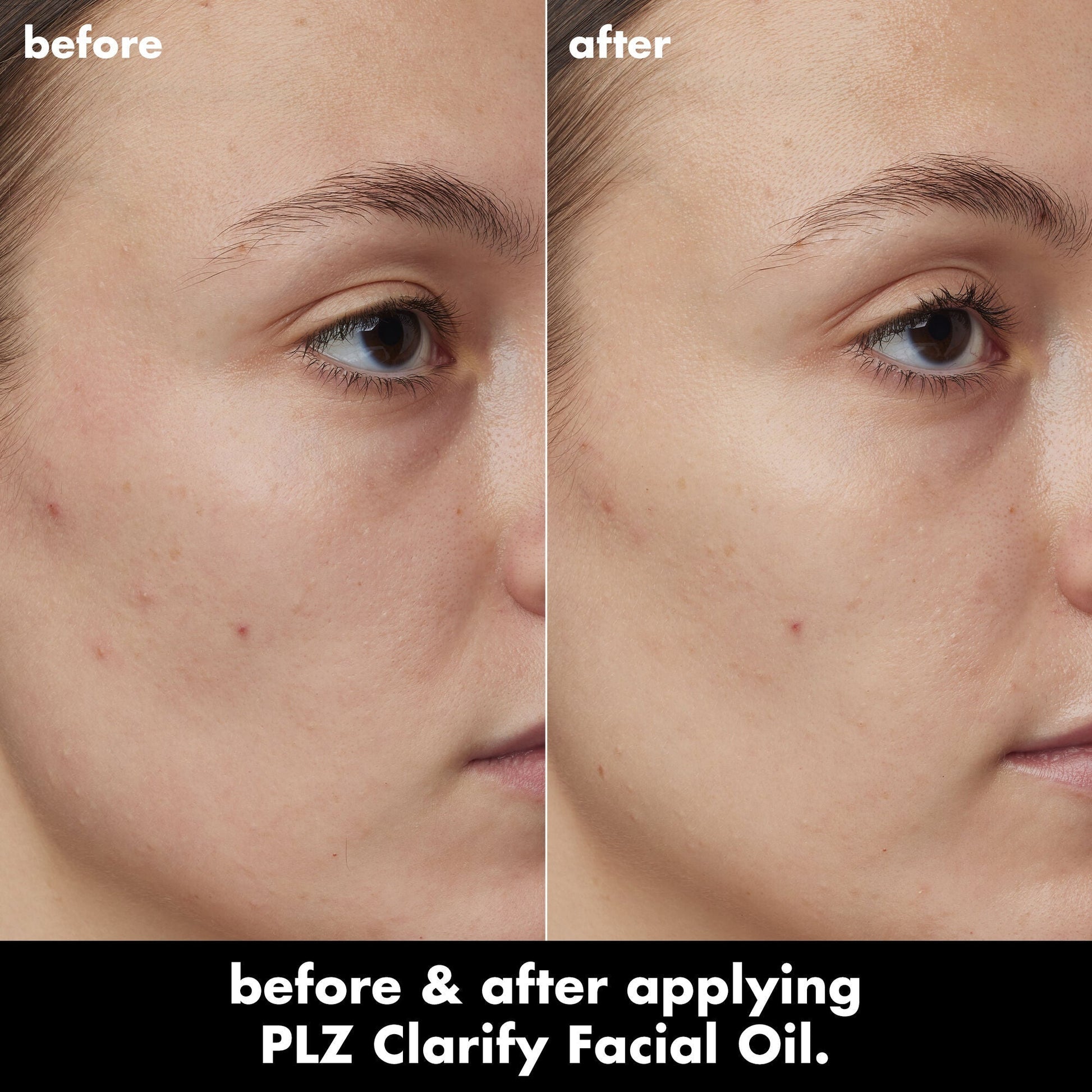 plz-clarify-facial-oil-s7 0326_EDU_PlzClarify_BA_Kelly.jpg