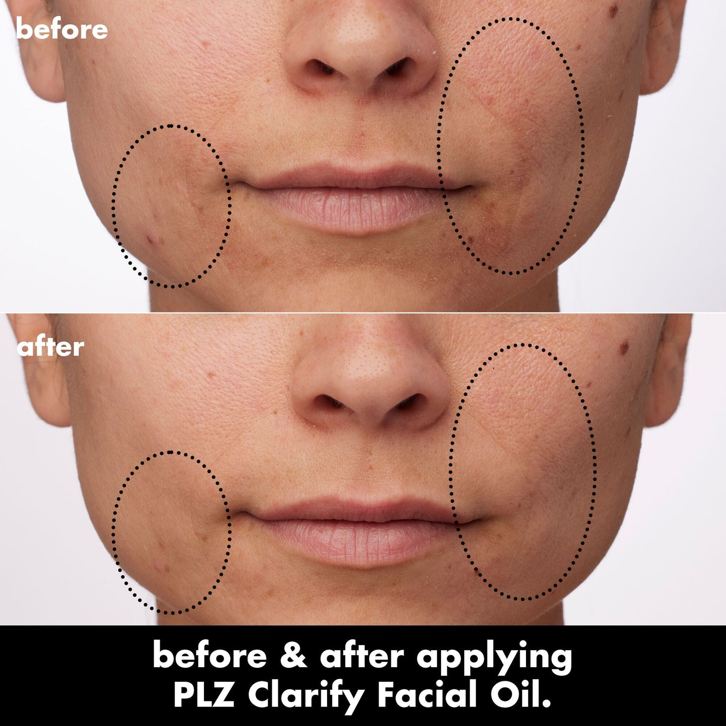 plz-clarify-facial-oil-s7 0326_EDU_PlzClarify_BA_Paula.jpg