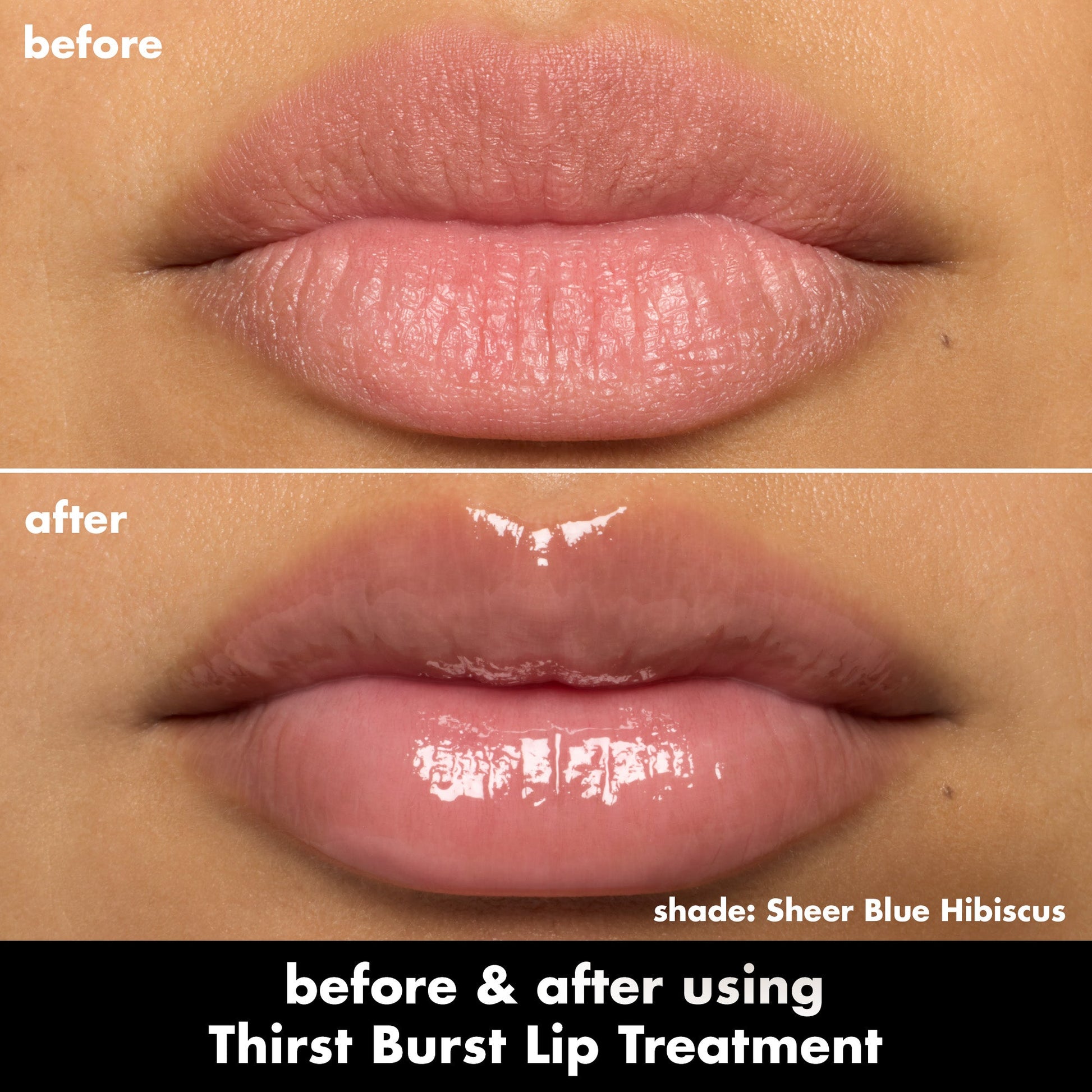 thirst-burst-lip-treatment-i0 0526_SEO_ThirstBurstLipTreatment_BA_SheerBlueHibiscus.jpg
