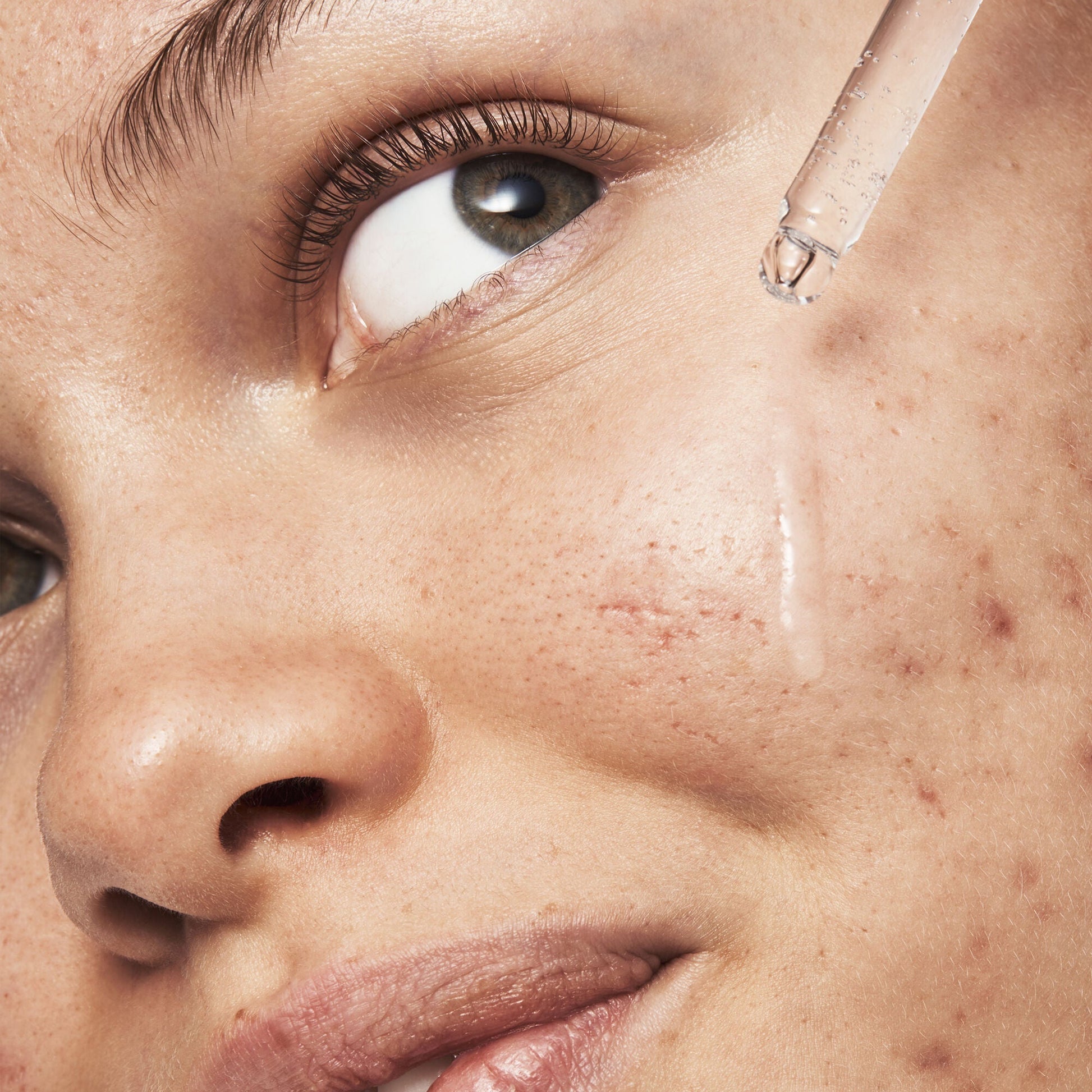 blemish-breakthrough-triple-acid-resurfacing-serum-p3 121321_Marley-Acne-Regimen_0254_FINAL_IGF.jpg