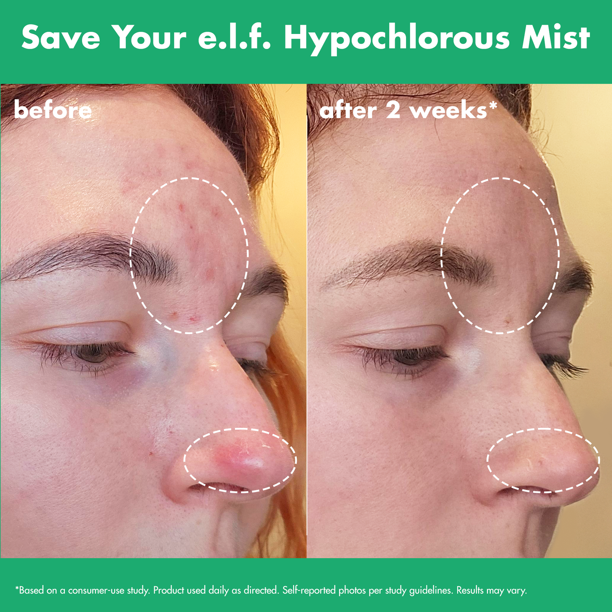 save-your-e-l-f-hypochlorous-mist-v1 FA26_EDUCATION_SAVEYOURELF_USAGE_BA1_WITHOUT_CLAIMS.png