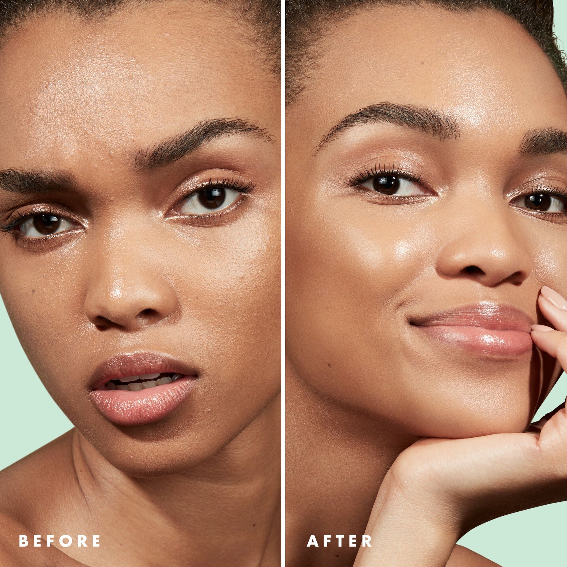 blemish-control-face-primer-large-size-h6 Primer_PP_Before_After_BlemishControl_2000x2000_3774231e-d4e1-49dd-b3d7-a73cbac901fe.jpg